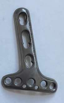 PLACA LCP ANGULO VARIABLE DISTAL DORSAL DE RADIO