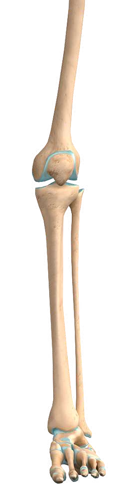 PLACA LCP TIBIA DISTAL ANTEROLATERAL DELTA
