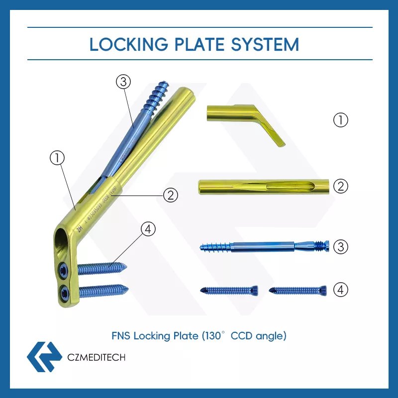 FNS (Sistema de cuello femoral) (3300-01) CZ-0001-3300-01