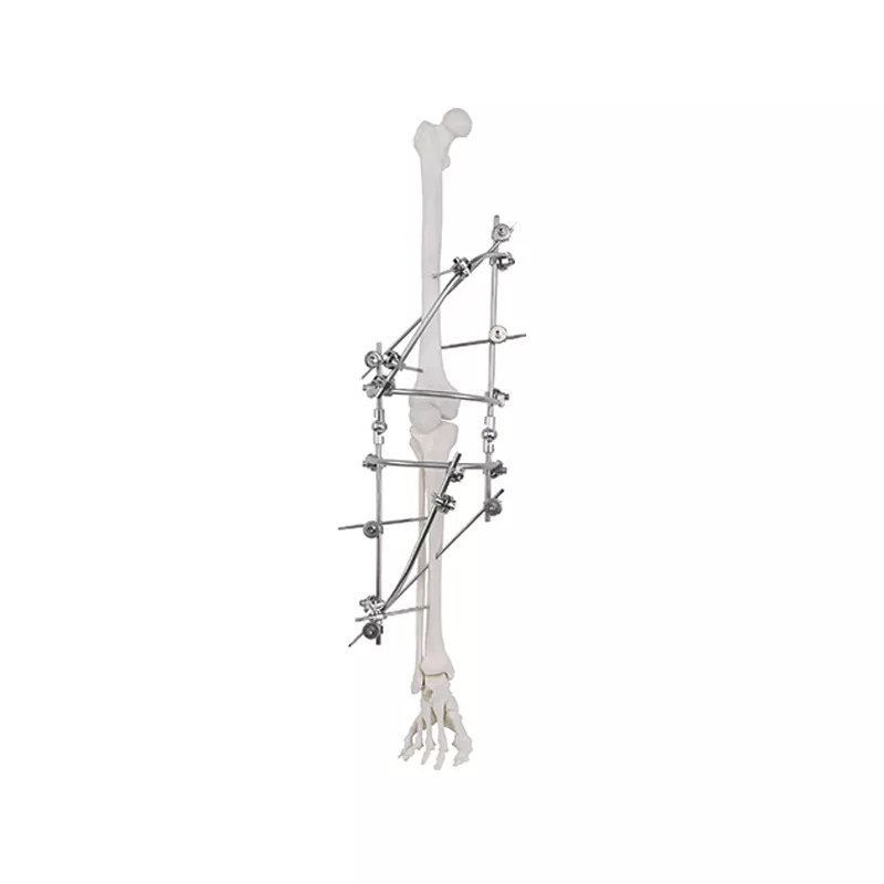 Junta de rodilla fijador externo 9100-2701