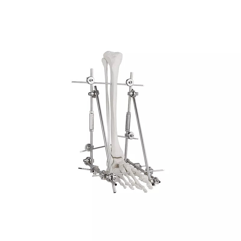 Junta de tobillo Fastador externo 9100-2401