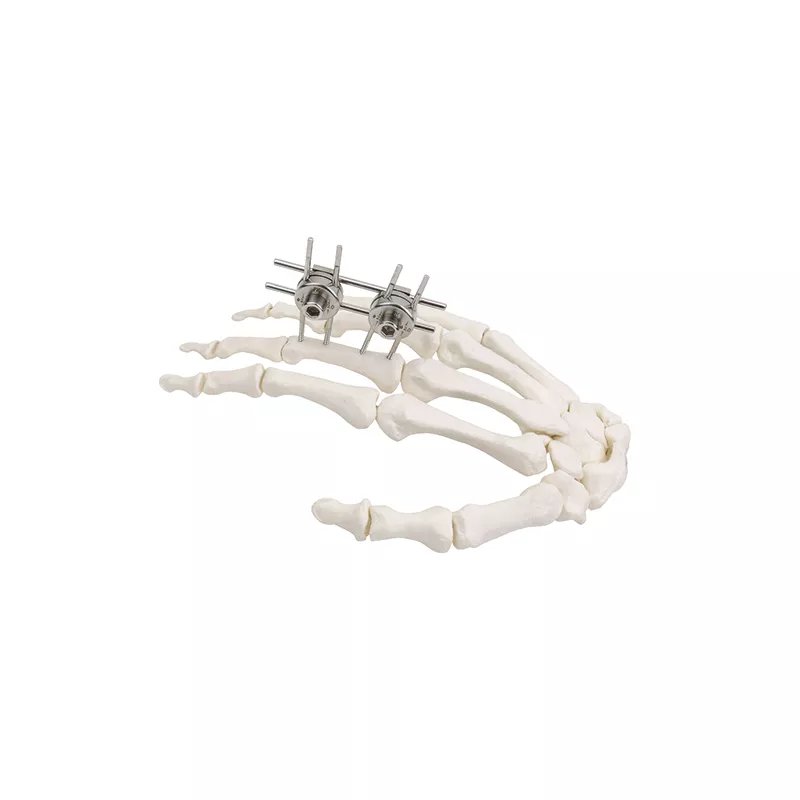 Mini-Expinatador EXTERNAL (Finger & Palm)