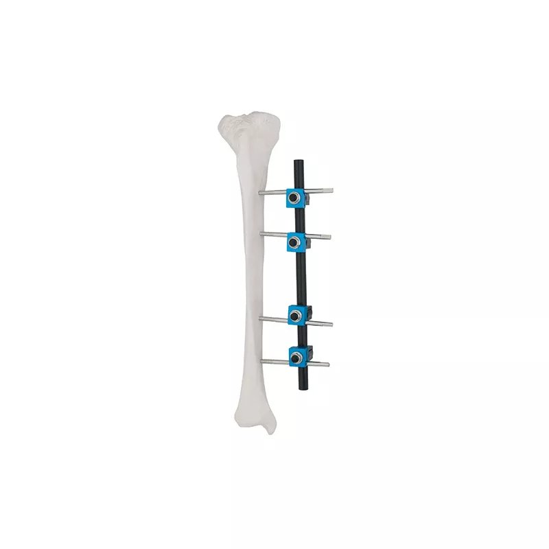 Tipo recto Fastador externo 8100-14