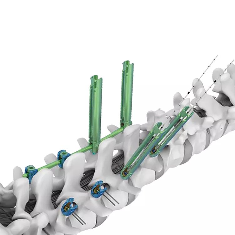 Sistema de tornillo cervical posterior