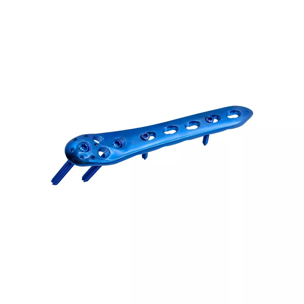 Placa de bloqueo femoral proximal-II