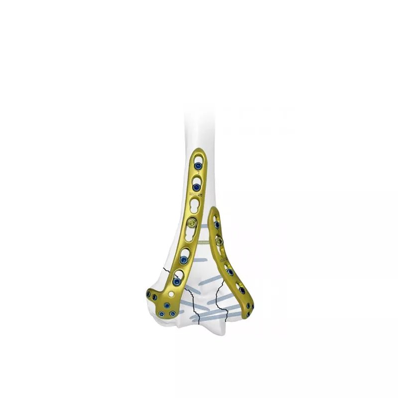 Placa de bloqueo humeral lateral distal