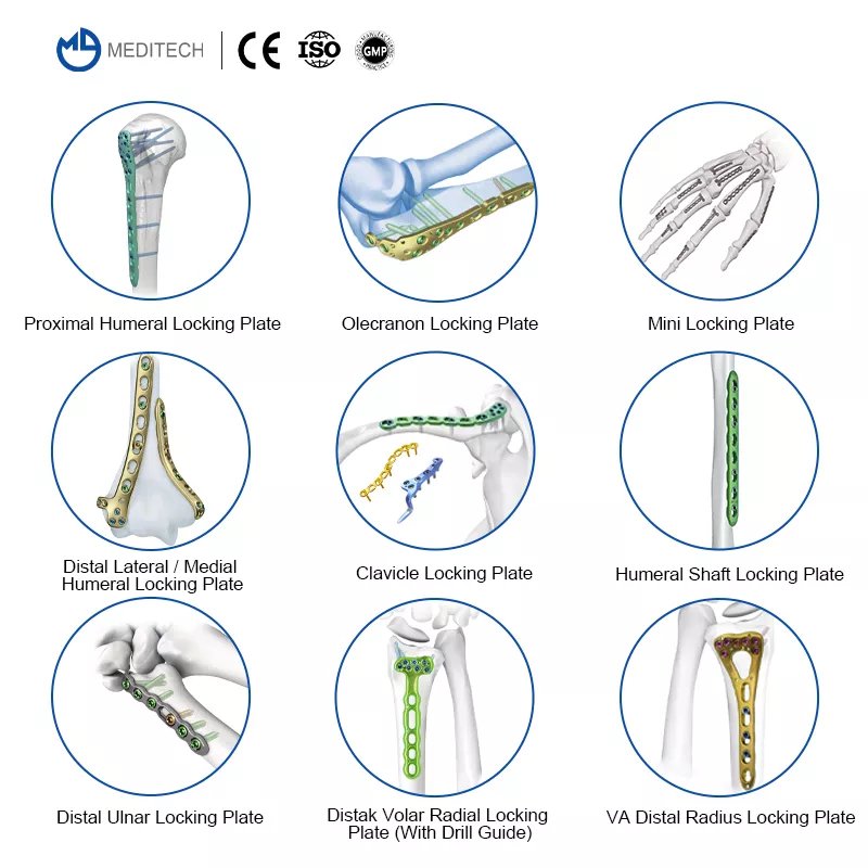 Tornillo de cortical de 2,4 mm